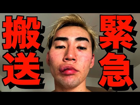 【暴行事件】登録者100万人以上の有名YouTuberに殴られました