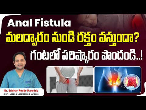 Fistula Symptoms and Treatment in Telugu || Fistula Causes in Telugu || Treatment Range Hospital