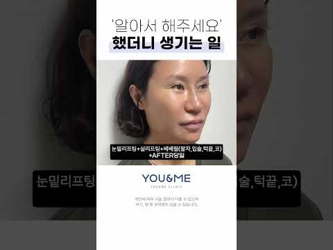 실리프팅, 눈밑리프팅, 베베필 리얼 후기