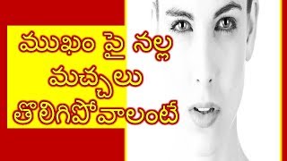 ముఖం పై నల్ల మచ్చలు తొలిగిపోవాలంటే - HOW TO GET RID OF BLACK SPOTS ON FACE HOME REMEDIES IN TELUGU