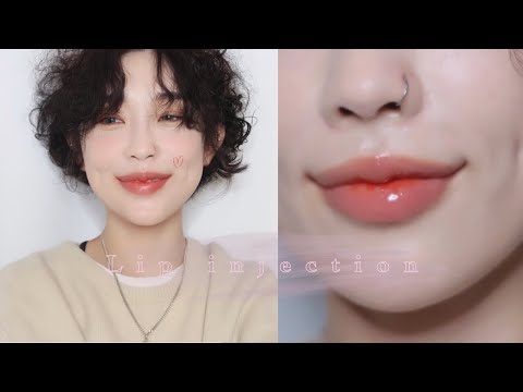 내돈내산 입술필러👄 (Lip injection)VLOG+tip💖당일~일주일, 2주차 feat.이마보톡스, 입꼬리 보톡스