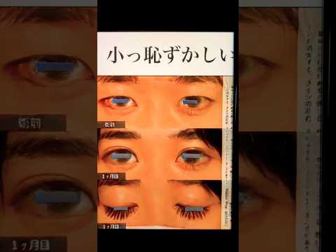 【顔面ヒエラルキー】J◯1とIN◯は&TEAMの下位互換だと個人的に思ってる〜二重埋没モニター