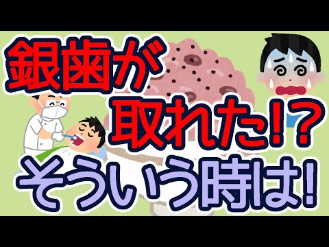 【1分雑学】銀歯が取れたらどうしたらいい？