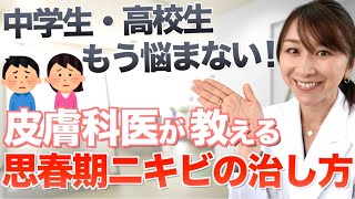 【皮膚科医が解説】思春期ニキビ、その原因と治療法