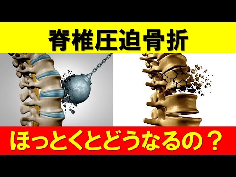 脊椎圧迫骨折をほっとくとどうなる？知っておくべきリスクと対策