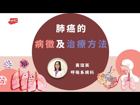 癌症｜肺癌的病徵及治療方法