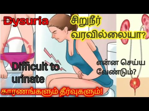 சிறுநீர் வரவில்லையா? | Difficult to urinate? | என்ன செய்யவேண்டும்? | Disuria urine problem in tamil