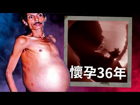 懷孕36年的男人【九卦】