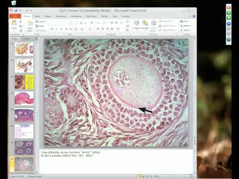 Medical School Pathology 2012 Session 063 Female Genital Tract II.mp4