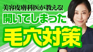 《美容皮膚科医が教える！》開いてしまった毛穴対策