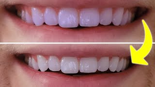 This New Calcium Supplement Cured My Sensitive Teeth In 3 Days