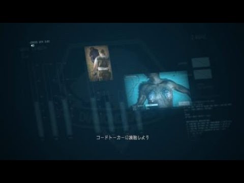 MGSV ルートコーズ