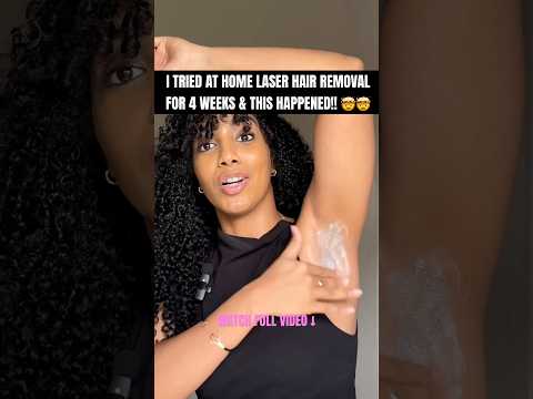 I Tried LASER HAIR REMOVAL AT HOME & THIS HAPPENED! | Before & After Results #shortsfeed