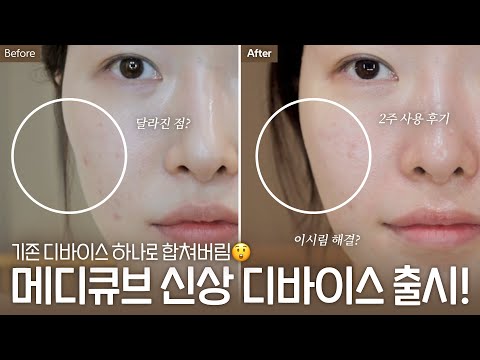 cc) 디바이스원조‼️메디큐브 프로 신제품출시 효과,기존모델,사용비교리뷰🔥새로사야될까??ㅣ아랑