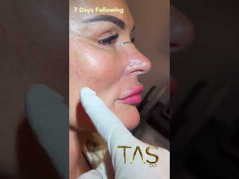 Facial Aesthetics by Dr. Suleyman TAS