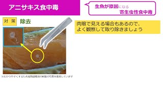 食中毒啓発ファイル　Ｆｉｌｅ1 アニサキス食中毒