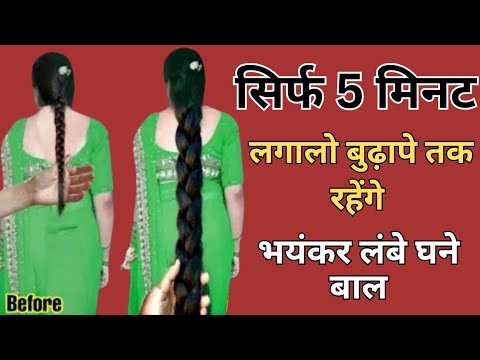 सिर्फ 5 मिनट लगालो बुढ़ापे तक भयानक लंबे घने मोटे रहेंगे बाल,baal badhane ke upay | Hair growth tips