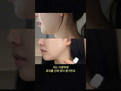 이중턱 없애주는 ㅇ모드 디바이스?ㅣ아랑 #세라매스