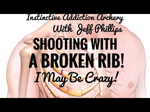 Shooting My Recurve With A Broken Rib! I Might Be Crazy!