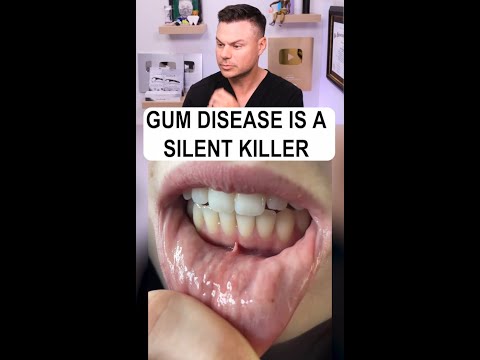 If you Have THIS, Your Gums COULD Be At Risk!