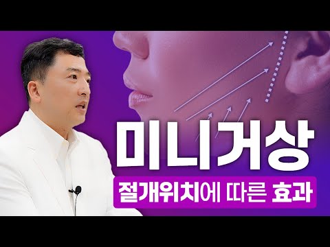 미니거상 절개 위치에 따른 효과, 귀앞절개 vs 두피절개 어느 것이 더 좋을까?