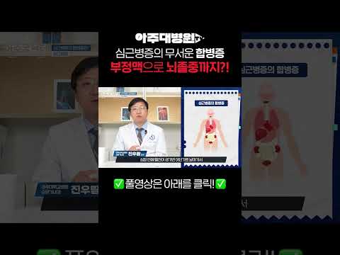 심근병증의 무서운 합병증 부정맥으로 뇌졸중까지?!