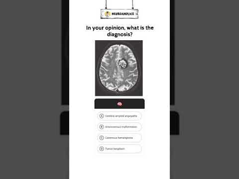 #NEUROQUIZ01| Neuroaholics #shorts #shortvideo #shortsyoutube