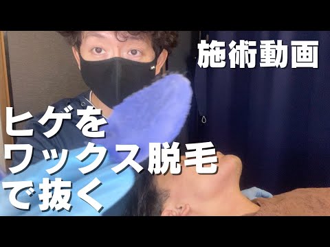 【施術動画】ワックス脱毛でヒゲを脱毛する【Wax脱毛】