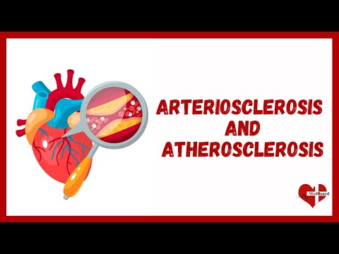 What is Atherosclerosis? | Overview of Atherosclerosis and Arteriosclerosis | MedBoard