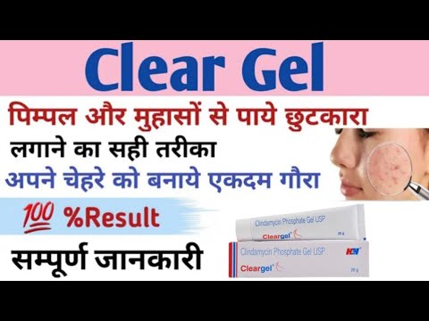 how to use clear Gel, how to apply clear Gel #cngajbhiye #cnmedicineinfo #cleargel