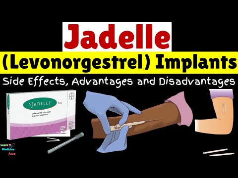 Jadelle (Levonorgestrel) Implants: What is Jadelle?, Side Effects, Advantages and Disadvantages