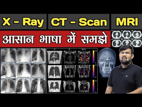 X - Ray | CT - scan | MRI | Chest X ray | Doctor  | BHMS | BAMS | BUMS | MBBS | Nursing | Pharmacy