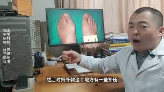 拇趾外翻怎么办？大脚骨凸起疼痛和治疗办法 hallux valgus