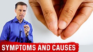 Iron Deficiency Symptoms and Causes of Anemia – Dr.Berg