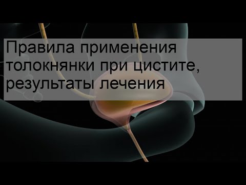 Правила применения толокнянки при цистите, результаты лечения