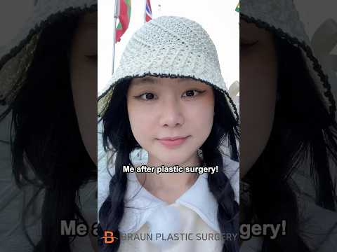 My plastic surgery changed my whole face!😱 #fyp #rhinoplasty #glowup #enhypen #plasticsurgerykorea