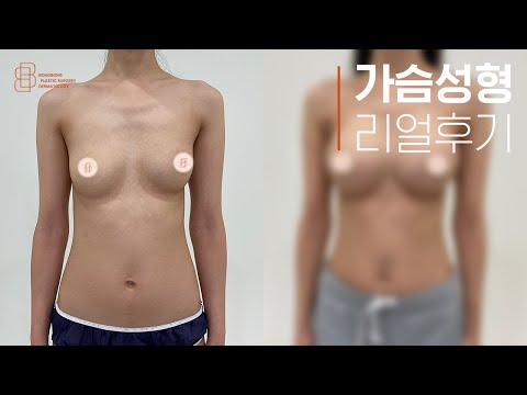 어제는 A컵가슴,   오늘부터 D컵 가슴으로 살아간다면?!