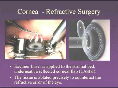 Medical School Pathology 2012 Session 076 Eye.mp4