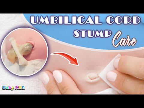 Umbilical Cord Stump Care || How to Take Care of the Umbilical Stump || Ways to Prevent Infection