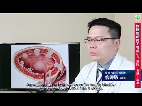 膀胱癌前兆不會痛 該如何預防發現治療 英文版Bladder cancer precursors are painless How to prevent, detect and treat