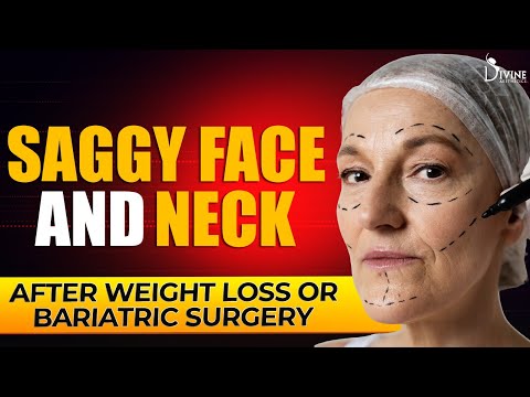 How to Address Saggy Face and Neck After Weight Loss or Bariatric Surgery?