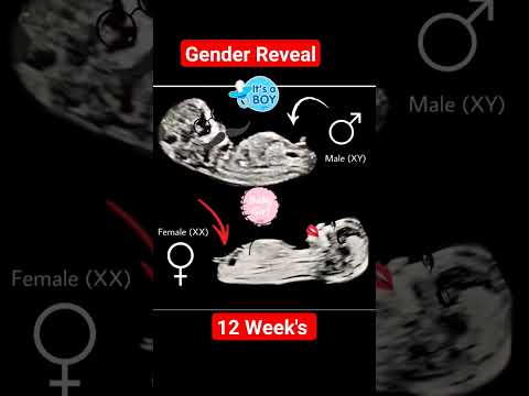 12 Week's Gender Reveal #babyultrasound #genderdetermination #genderpredictions