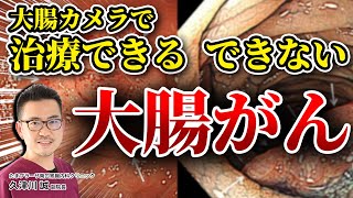 大腸カメラ検査で完治できる大腸がんと完治できない大腸がん 　良性のポリープ切除はがんの予防にも!! 教えて久津川先生 No195