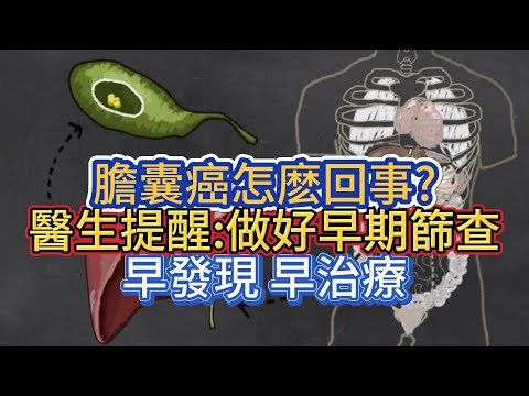 膽囊癌怎麽回事?醫生提醒:做好早期篩查，早發現，早治療