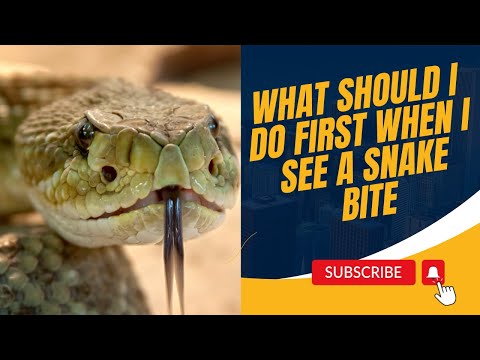 WHAT SHOULD I DO FIRST WHEN I SEE A SNAKE BITE