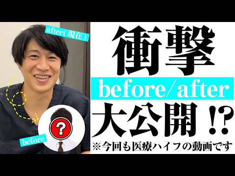 【医療ハイフ】レーザーで若返り！リフトアップ！人気のウルトラリフトプラスHIFUついて☆その②【美の主治医京様】