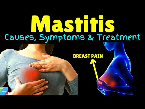 Mastitis | Breast Infection - Symptoms, Causes, Treatment, Prevention