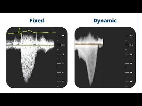 American Society of Echocardiography: Training Module 5