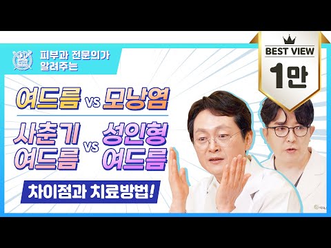 여드름 vs 모낭염, 사춘기 여드름 vs 성인 여드름 I 차이점과 치료방법!