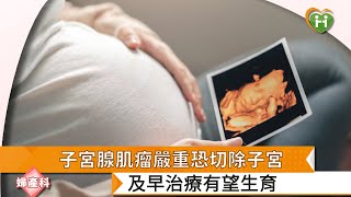 【林大欽部長】子宮腺肌瘤嚴重恐切除子宮　及早治療有望生育｜健康醫療網